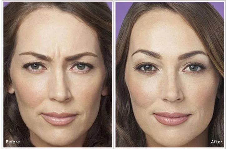Non-Surgical Aesthetic Services